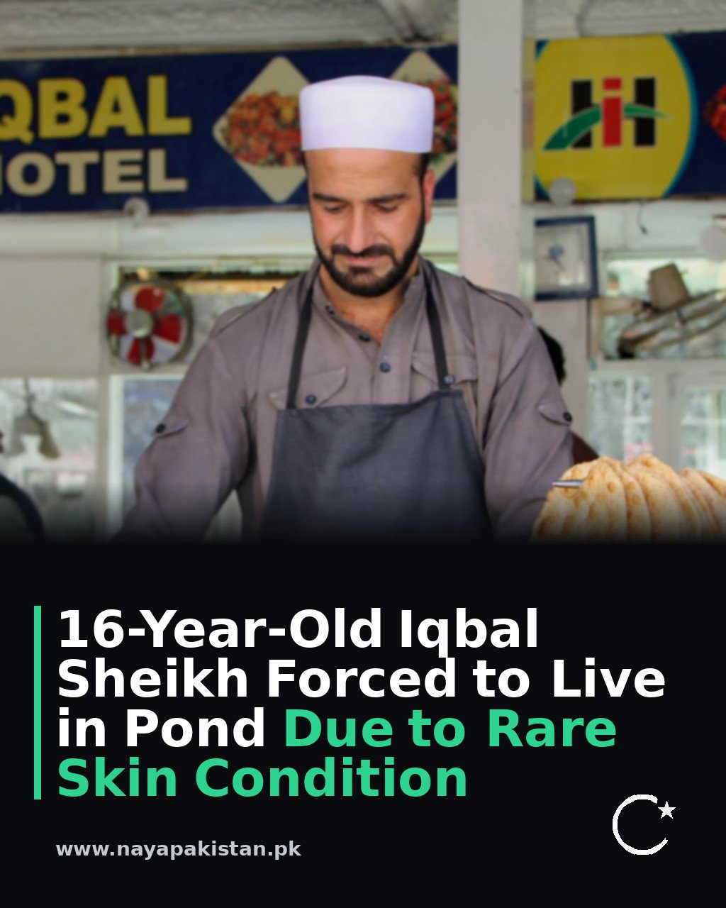 16-Year-Old Iqbal Sheikh Forced to Live in Pond Due to Rare Skin Condition