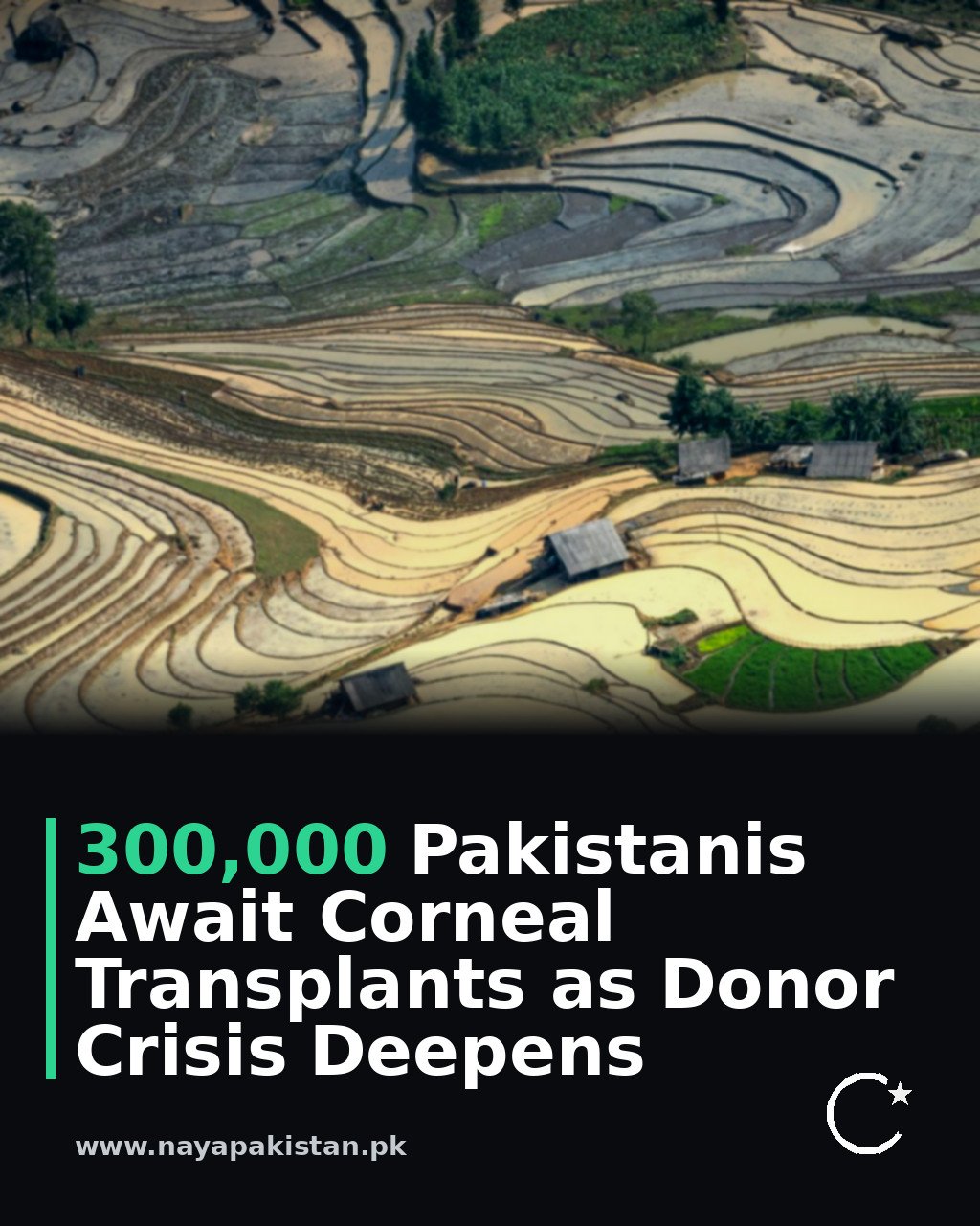 300,000 Pakistanis Await Corneal Transplants as Donor Crisis Deepens
