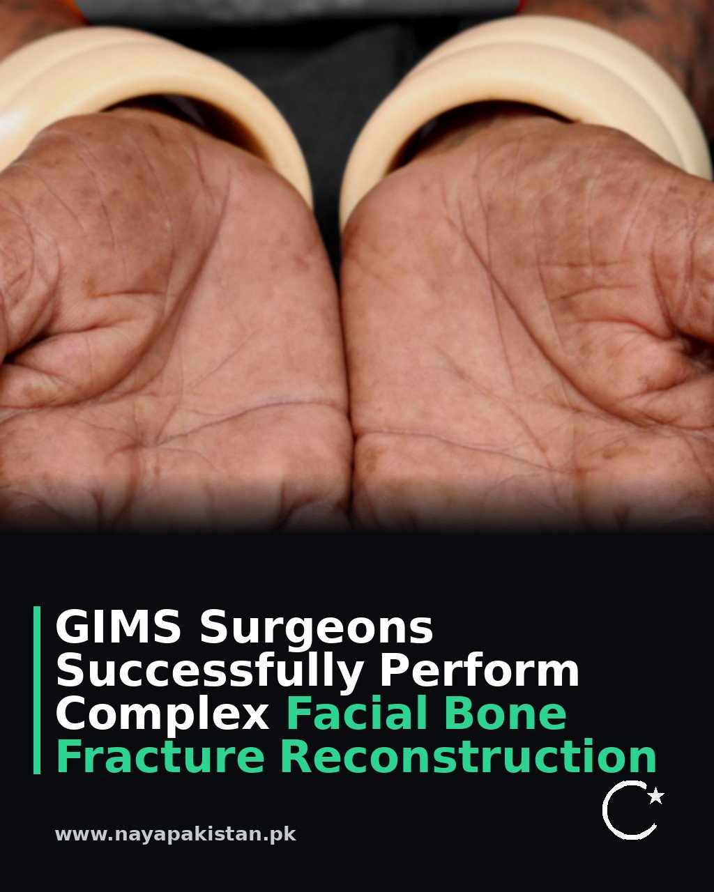 GIMS Surgeons Successfully Perform Complex Facial Bone Fracture Reconstruction